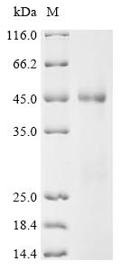 (Tris-Glycine gel) Discontinuous SDS-PAGE (reduced) with 5% enrichment gel and 15% separation gel.