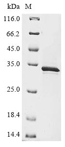 (Tris-Glycine gel) Discontinuous SDS-PAGE (reduced) with 5% enrichment gel and 15% separation gel. (Tris-Glycine gel) Discontinuous SDS-PAGE (reduced) with 5% enrichment gel and 15% separation gel.