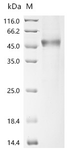 (Tris-Glycine gel) Discontinuous SDS-PAGE (reduced) with 5% enrichment gel and 15% separation gel.