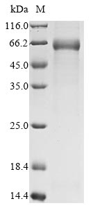 (Tris-Glycine gel) Discontinuous SDS-PAGE (reduced) with 5% enrichment gel and 15% separation gel. (Tris-Glycine gel) Discontinuous SDS-PAGE (reduced) with 5% enrichment gel and 15% separation gel.