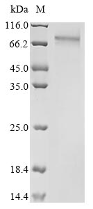 (Tris-Glycine gel) Discontinuous SDS-PAGE (reduced) with 5% enrichment gel and 15% separation gel. (Tris-Glycine gel) Discontinuous SDS-PAGE (reduced) with 5% enrichment gel and 15% separation gel.