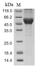 (Tris-Glycine gel) Discontinuous SDS-PAGE (reduced) with 5% enrichment gel and 15% separation gel. (Tris-Glycine gel) Discontinuous SDS-PAGE (reduced) with 5% enrichment gel and 15% separation gel.
