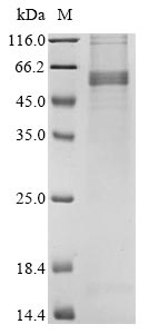 (Tris-Glycine gel) Discontinuous SDS-PAGE (reduced) with 5% enrichment gel and 15% separation gel. (Tris-Glycine gel) Discontinuous SDS-PAGE (reduced) with 5% enrichment gel and 15% separation gel.