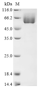 (Tris-Glycine gel) Discontinuous SDS-PAGE (reduced) with 5% enrichment gel and 15% separation gel. (Tris-Glycine gel) Discontinuous SDS-PAGE (reduced) with 5% enrichment gel and 15% separation gel.