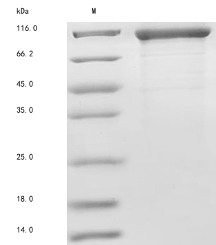 (Tris-Glycine gel) Discontinuous SDS-PAGE (reduced) with 5% enrichment gel and 15% separation gel. (Tris-Glycine gel) Discontinuous SDS-PAGE (reduced) with 5% enrichment gel and 15% separation gel.