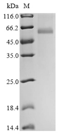 (Tris-Glycine gel) Discontinuous SDS-PAGE (reduced) with 5% enrichment gel and 15% separation gel. (Tris-Glycine gel) Discontinuous SDS-PAGE (reduced) with 5% enrichment gel and 15% separation gel.