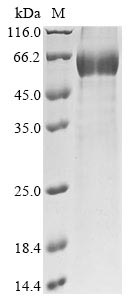 Recombinant Mouse Sclerostin (Sost) - image 1