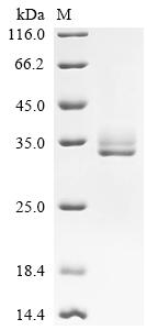 Recombinant Mouse Calcitonin gene-related peptide 1 (Calca) , partial - image 1
