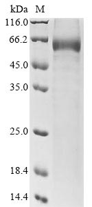 Recombinant Rat Sclerostin (Sost) - image 1