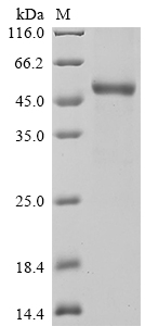 (Tris-Glycine gel) Discontinuous SDS-PAGE (reduced) with 5% enrichment gel and 15% separation gel. (Tris-Glycine gel) Discontinuous SDS-PAGE (reduced) with 5% enrichment gel and 15% separation gel.