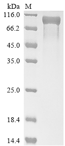 (Tris-Glycine gel) Discontinuous SDS-PAGE (reduced) with 5% enrichment gel and 15% separation gel. (Tris-Glycine gel) Discontinuous SDS-PAGE (reduced) with 5% enrichment gel and 15% separation gel.
