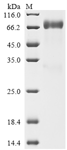 (Tris-Glycine gel) Discontinuous SDS-PAGE (reduced) with 5% enrichment gel and 15% separation gel. (Tris-Glycine gel) Discontinuous SDS-PAGE (reduced) with 5% enrichment gel and 15% separation gel.