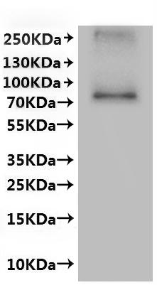 CSB-MP861992HU is detected by Mouse anti-6*His monoclonal antibody.