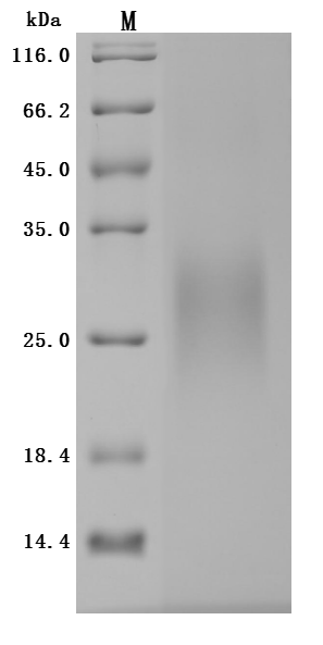 CSB-MP862025HU SDS-PAGE