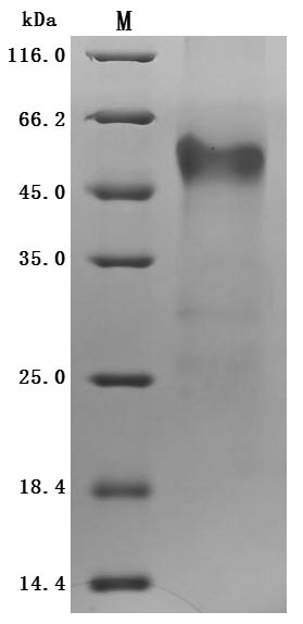 CSB-MP862025HUd9 SDS-PAGE