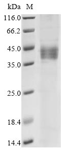 (Tris-Glycine gel) Discontinuous SDS-PAGE (reduced) with 5% enrichment gel and 15% separation gel. (Tris-Glycine gel) Discontinuous SDS-PAGE (reduced) with 5% enrichment gel and 15% separation gel.