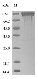 CSB-MP866317HU SDS-PAGE