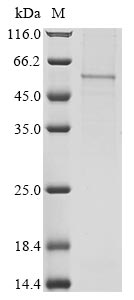 Recombinant Human COMM domain-containing protein 5 (COMMD5) - image 1