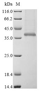 (Tris-Glycine gel) Discontinuous SDS-PAGE (reduced) with 5% enrichment gel and 15% separation gel.