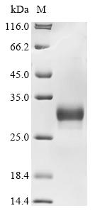 Recombinant Mouse Collagen triple helix repeat-containing protein 1 (Cthrc1) - image 1