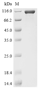 (Tris-Glycine gel) Discontinuous SDS-PAGE (reduced) with 5% enrichment gel and 15% separation gel. (Tris-Glycine gel) Discontinuous SDS-PAGE (reduced) with 5% enrichment gel and 15% separation gel.