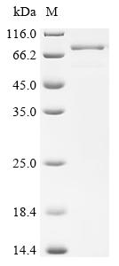 Recombinant Human Adipocyte plasma membrane-associated protein (APMAP) , partial - image 1