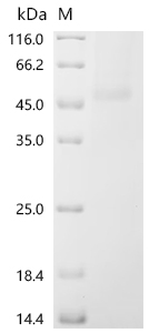 Recombinant Human Adipocyte plasma membrane-associated protein (APMAP) , partial - image 1