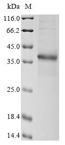 (Tris-Glycine gel) Discontinuous SDS-PAGE (reduced) with 5% enrichment gel and 15% separation gel.
