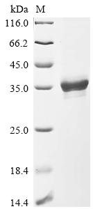 (Tris-Glycine gel) Discontinuous SDS-PAGE (reduced) with 5% enrichment gel and 15% separation gel. (Tris-Glycine gel) Discontinuous SDS-PAGE (reduced) with 5% enrichment gel and 15% separation gel.