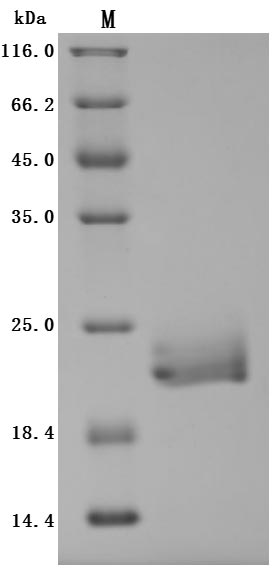 CSB-MP890933HU SDS-PAGE