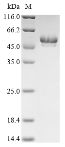 (Tris-Glycine gel) Discontinuous SDS-PAGE (reduced) with 5% enrichment gel and 15% separation gel. (Tris-Glycine gel) Discontinuous SDS-PAGE (reduced) with 5% enrichment gel and 15% separation gel.