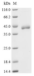 (Tris-Glycine gel) Discontinuous SDS-PAGE (reduced) with 5% enrichment gel and 15% separation gel.