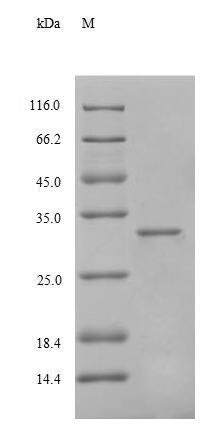 SDS-PAGE- Recombinant protein Human AHSG