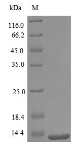 (Tris-Glycine gel) Discontinuous SDS-PAGE (reduced) with 5% enrichment gel and 15% separation gel. (Tris-Glycine gel) Discontinuous SDS-PAGE (reduced) with 5% enrichment gel and 15% separation gel.