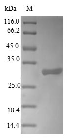 (Tris-Glycine gel) Discontinuous SDS-PAGE (reduced) with 5% enrichment gel and 15% separation gel. (Tris-Glycine gel) Discontinuous SDS-PAGE (reduced) with 5% enrichment gel and 15% separation gel.