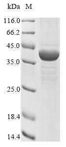 Recombinant Human Acetyl-CoA acetyltransferase, mitochondrial (ACAT1) - image 1