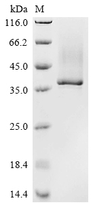 Recombinant Human Tartrate-resistant acid phosphatase type 5 (ACP5) - image 1