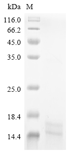 (Tris-Glycine gel) Discontinuous SDS-PAGE (reduced) with 5% enrichment gel and 15% separation gel. (Tris-Glycine gel) Discontinuous SDS-PAGE (reduced) with 5% enrichment gel and 15% separation gel.