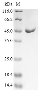 (Tris-Glycine gel) Discontinuous SDS-PAGE (reduced) with 5% enrichment gel and 15% separation gel. (Tris-Glycine gel) Discontinuous SDS-PAGE (reduced) with 5% enrichment gel and 15% separation gel.