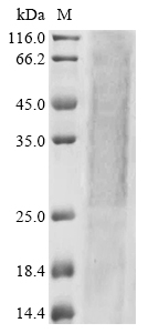 Recombinant Rat Aldehyde dehydrogenase, mitochondrial (Aldh2) - image 1