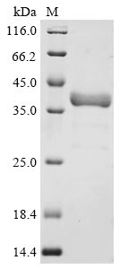 (Tris-Glycine gel) Discontinuous SDS-PAGE (reduced) with 5% enrichment gel and 15% separation gel. (Tris-Glycine gel) Discontinuous SDS-PAGE (reduced) with 5% enrichment gel and 15% separation gel.