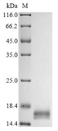 (Tris-Glycine gel) Discontinuous SDS-PAGE (reduced) with 5% enrichment gel and 15% separation gel. (Tris-Glycine gel) Discontinuous SDS-PAGE (reduced) with 5% enrichment gel and 15% separation gel.
