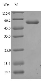 (Tris-Glycine gel) Discontinuous SDS-PAGE (reduced) with 5% enrichment gel and 15% separation gel. (Tris-Glycine gel) Discontinuous SDS-PAGE (reduced) with 5% enrichment gel and 15% separation gel.
