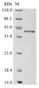 Recombinant Human AnneXIn A1 (ANXA1) - image 1