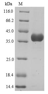 (Tris-Glycine gel) Discontinuous SDS-PAGE (reduced) with 5% enrichment gel and 15% separation gel. (Tris-Glycine gel) Discontinuous SDS-PAGE (reduced) with 5% enrichment gel and 15% separation gel.