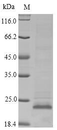 (Tris-Glycine gel) Discontinuous SDS-PAGE (reduced) with 5% enrichment gel and 15% separation gel. (Tris-Glycine gel) Discontinuous SDS-PAGE (reduced) with 5% enrichment gel and 15% separation gel.