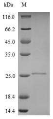 (Tris-Glycine gel) Discontinuous SDS-PAGE (reduced) with 5% enrichment gel and 15% separation gel. (Tris-Glycine gel) Discontinuous SDS-PAGE (reduced) with 5% enrichment gel and 15% separation gel.