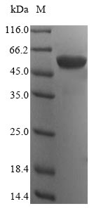 (Tris-Glycine gel) Discontinuous SDS-PAGE (reduced) with 5% enrichment gel and 15% separation gel. (Tris-Glycine gel) Discontinuous SDS-PAGE (reduced) with 5% enrichment gel and 15% separation gel.