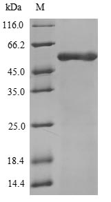 (Tris-Glycine gel) Discontinuous SDS-PAGE (reduced) with 5% enrichment gel and 15% separation gel. (Tris-Glycine gel) Discontinuous SDS-PAGE (reduced) with 5% enrichment gel and 15% separation gel.
