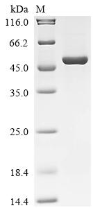 (Tris-Glycine gel) Discontinuous SDS-PAGE (reduced) with 5% enrichment gel and 15% separation gel.